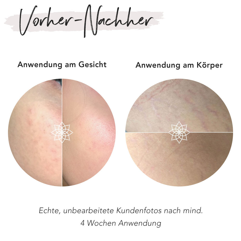 Microneedling Set Basic