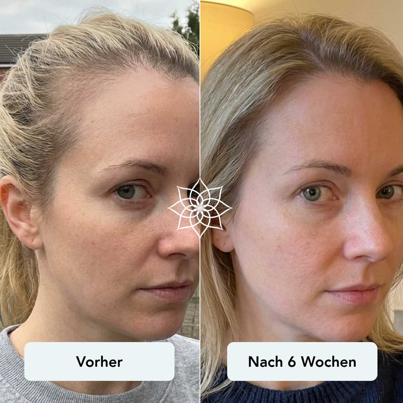 260113_Vorher_Nachher Bilder_Haarwachstum 04.jpg__PID:3c5d33f0-b6eb-4791-a0de-5adc0e96d6e2