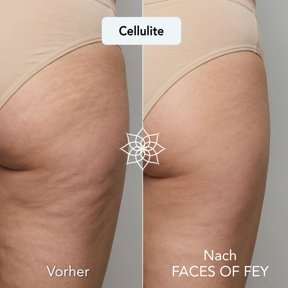 Body Renewal Microneedling System