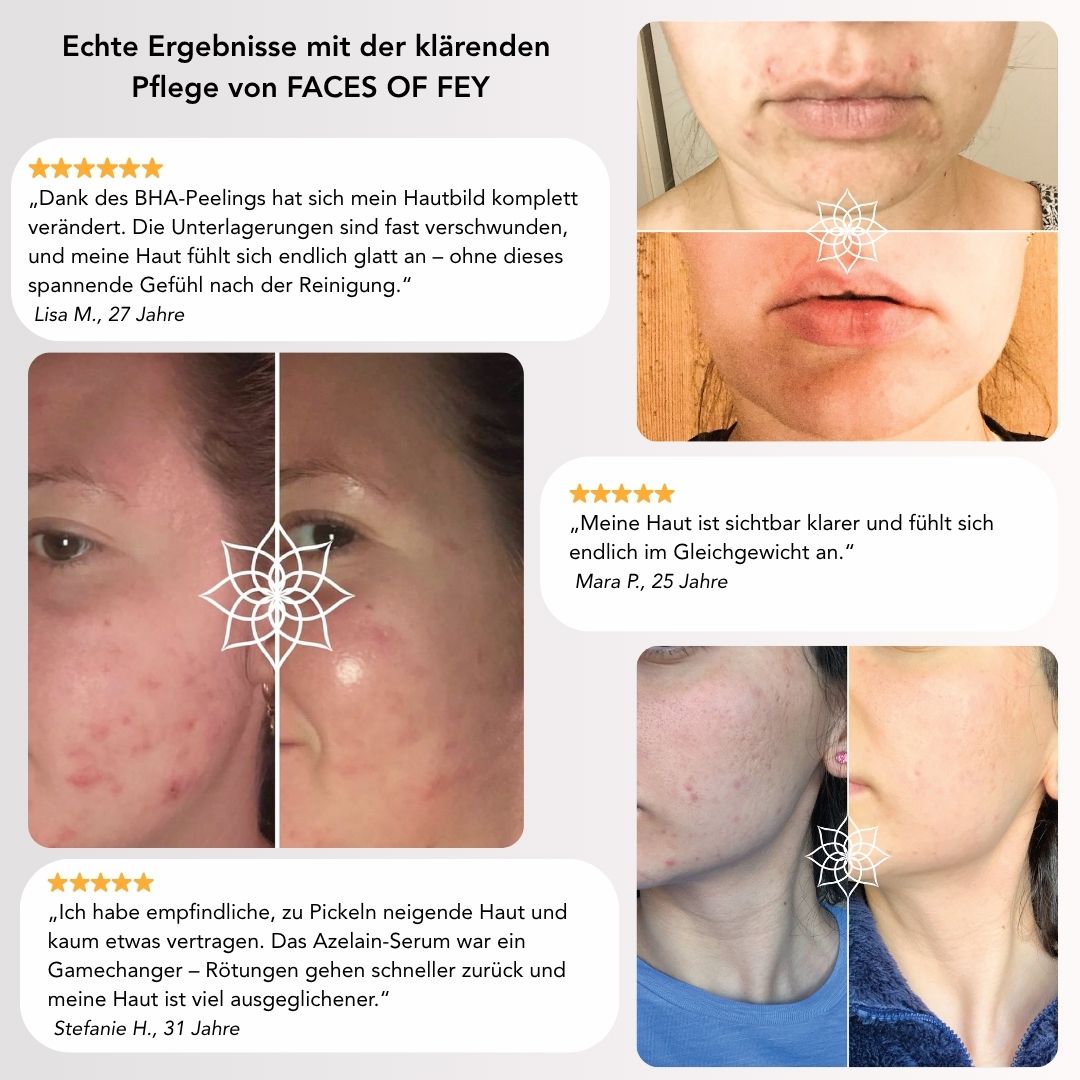 Glow & Control - Pflege für reine Haut