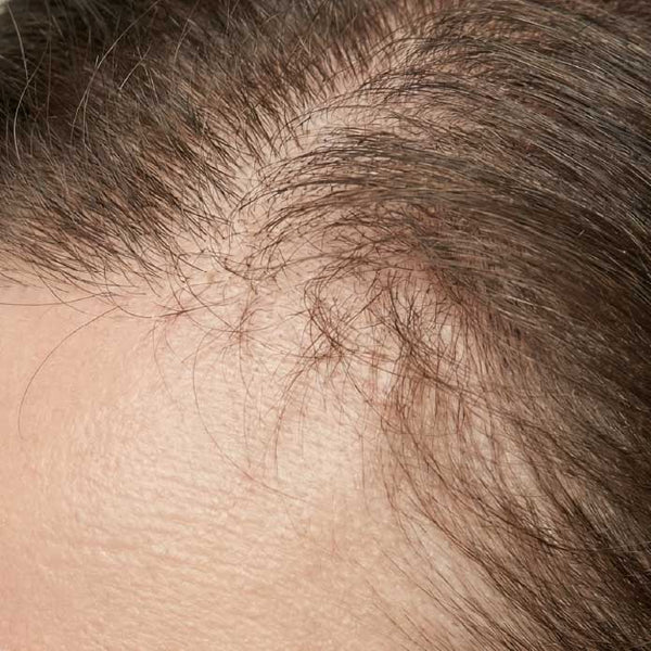 Haarwachstum anregen