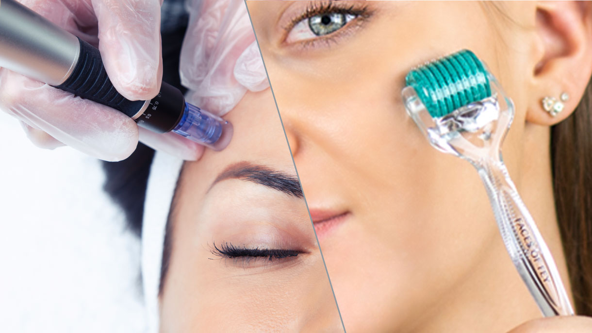Dermapen vs. Dermaroller