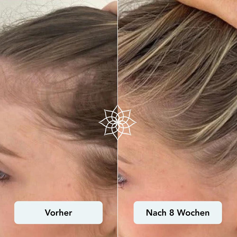 260113_Vorher_Nachher-Bilder_Haarwachstum-08.jpg__PID:14b37555-1129-496e-8f15-919a6f65f70f