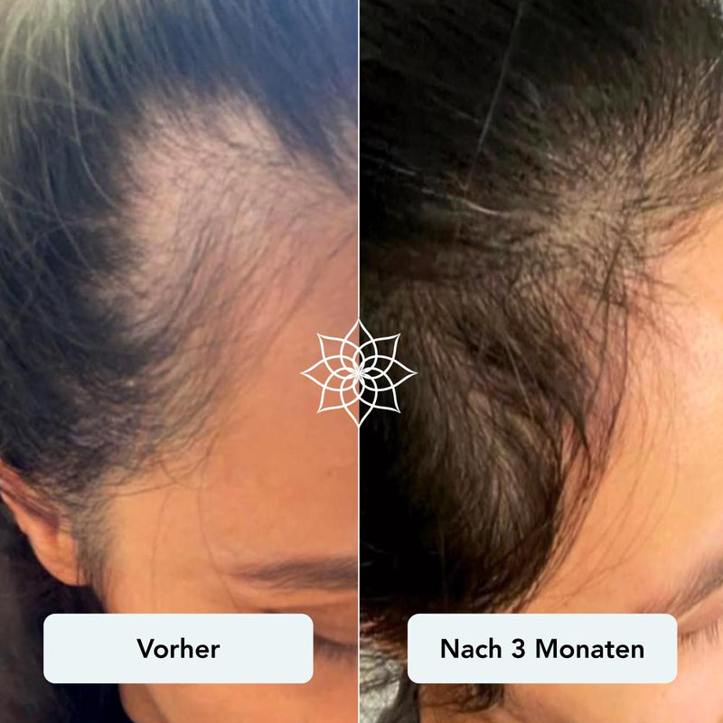260113_Vorher_Nachher-Bilder_Haarwachstum-09.jpg__PID:b3755511-2909-4e0f-9591-9a6f65f70fd9