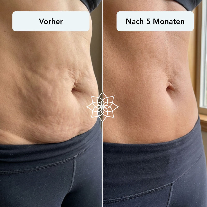 260115_Listingbilder_Body-Microneedling-System_schlaffe-Haut-nach-Abnahme.jpg__PID:13007736-ac2d-44be-8444-6a56f61583d8