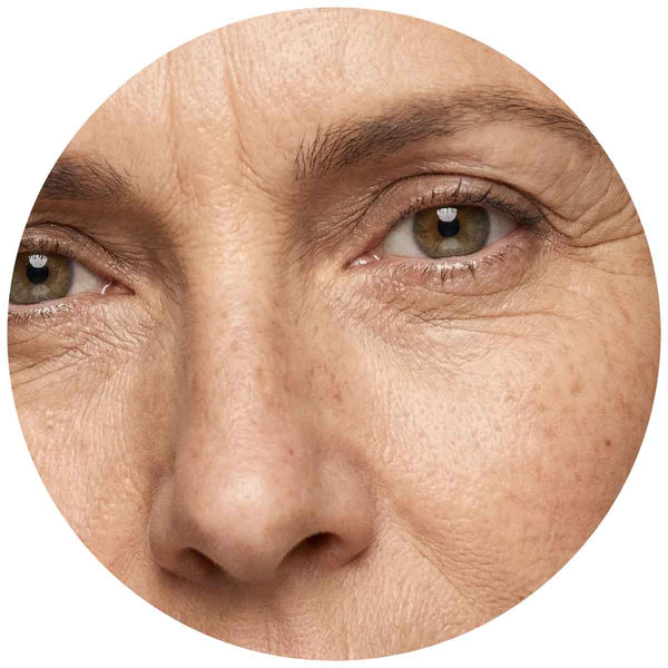 Feine Linien & Hautalterung 