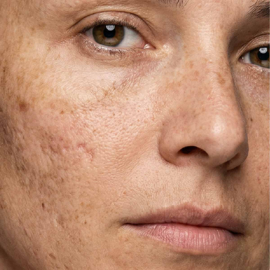 Hauttypen & Hautzustände