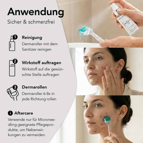 Blemish Control Microneedling System