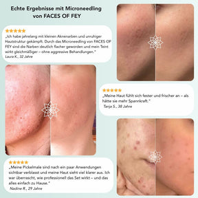 Glow & Discover - Microneedling Essentials
